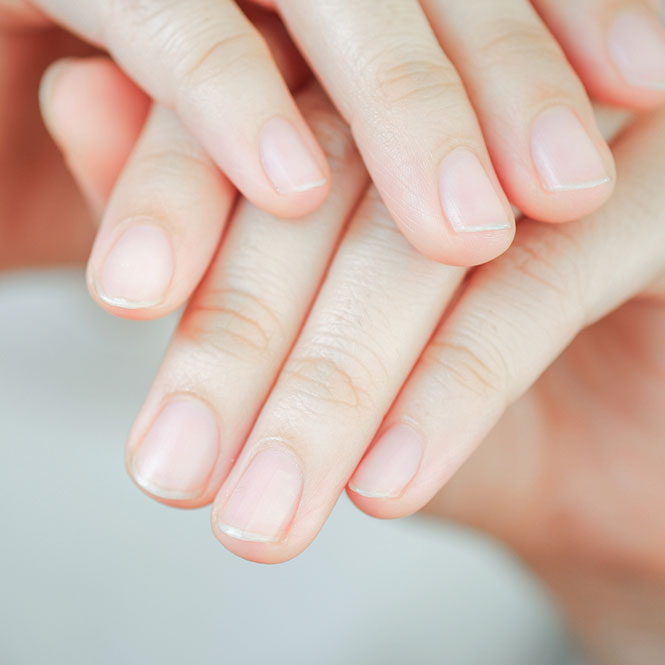 malattie delle unghie