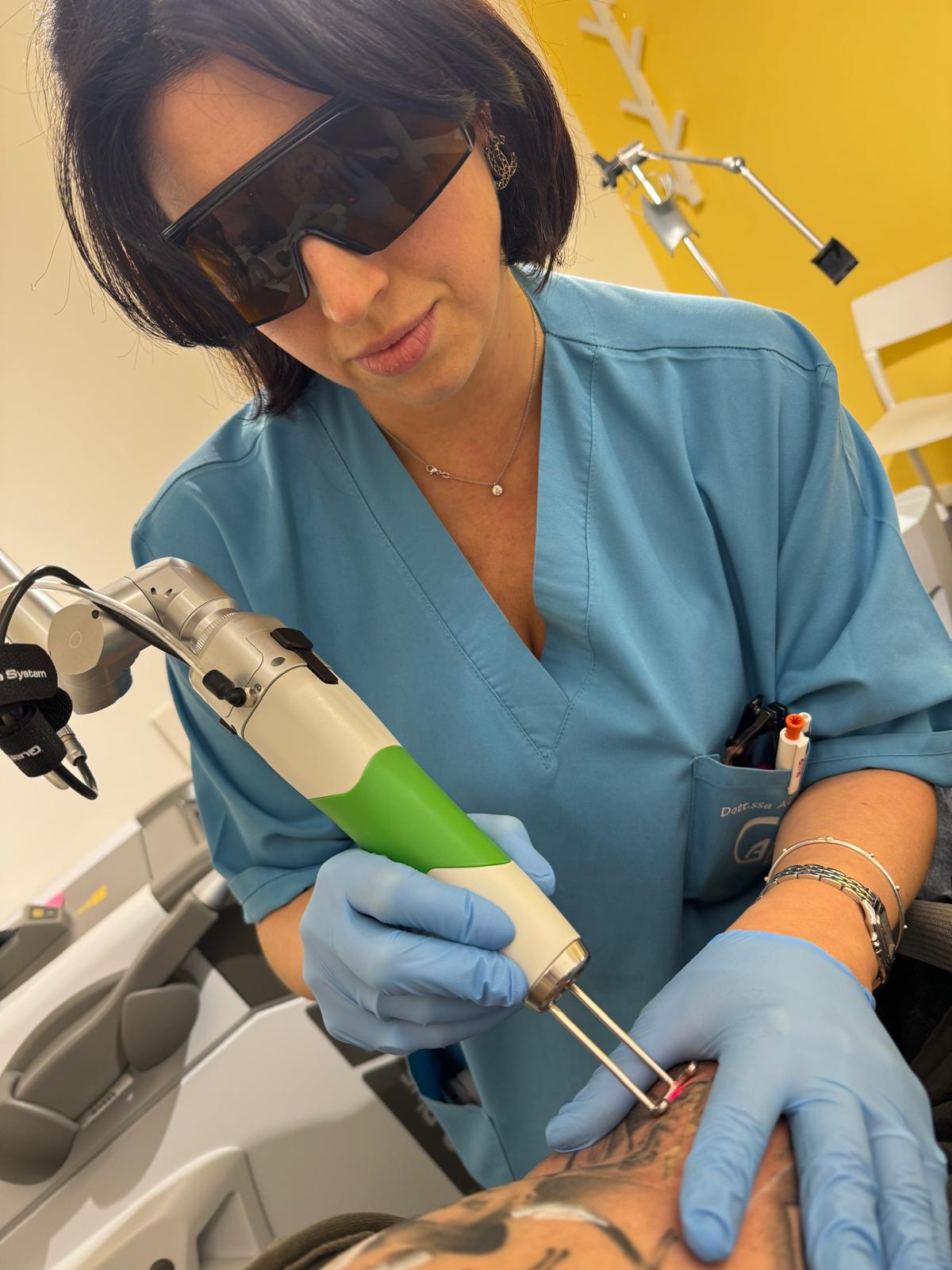 rimozione tattoo con Laser Q-Switched